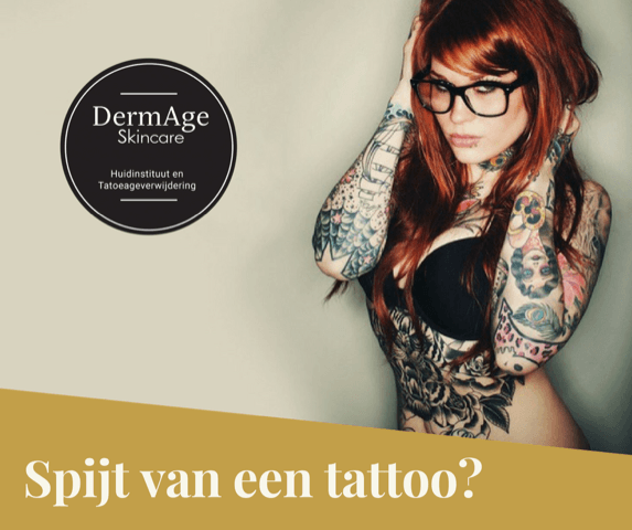 Tattoo verwijderen of verbleken voor cover-up?